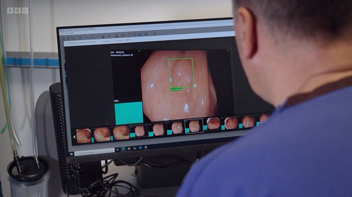 COLO-DETECT Featured on BBC Morning Live